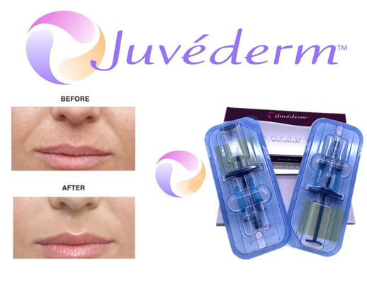 2x1ml Cross Linked Juvederm Dermal Filler Untuk Pengisian Kerut Wajah