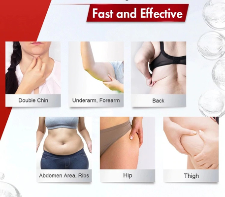 Solusi Lipolisis Injeksi Penurunan Berat Badan Untuk Melarutkan Lemak