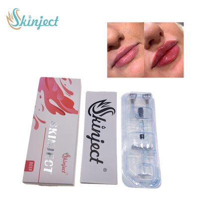 Skinject Deep Hyaluronic Acid Dermal 2ml Pengisi Bibir Suntik