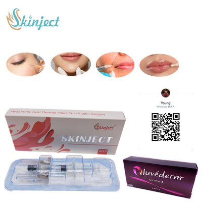 Suntik Skinject Deep HA Dermal 2ml Pengisi Bibir Pipi Dagu Nasolabial Lipat