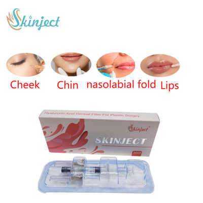Suntik Skinject Deep HA Dermal 2ml Pengisi Bibir Pipi Dagu Nasolabial Lipat