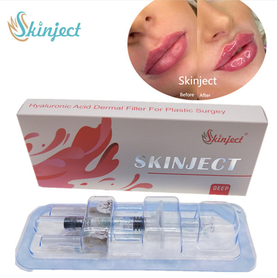 Suntik Skinject Deep HA Dermal 2ml Pengisi Bibir Pipi Dagu Nasolabial Lipat