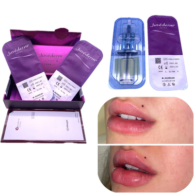 Injection Ha Filler Juvederm 2x1ml Peningkatan Bibir Menghilangkan Keriput