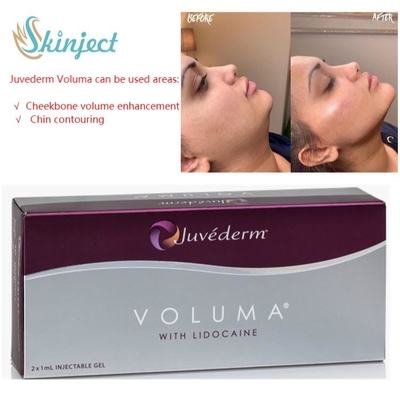 Perawatan Wajah 2x1ml Juvederm Pengisi Bibir Asam Hyaluronic Dermal Injectable