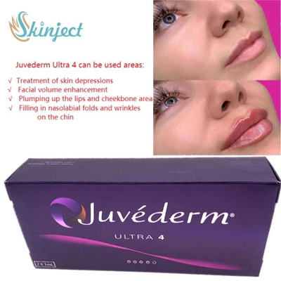 Perawatan Wajah 2x1ml Juvederm Pengisi Bibir Asam Hyaluronic Dermal Injectable