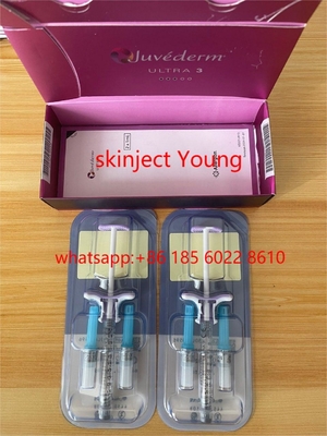 Juvederm Ultra 3 2x1ml Garis Wajah Asam Hyaluronic Pengisi Dermal Untuk Keriput
