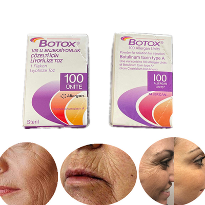 Edisi Bahasa Inggris Type A Botulinum Toxin 100 Iu Allergan  Untuk Keriput