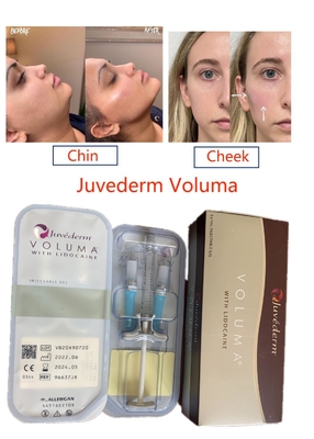 Juvederm Voluma Crosslinked Pengisi Asam Hyaluronic Wajah Tahan Lama Injeksi Murni
