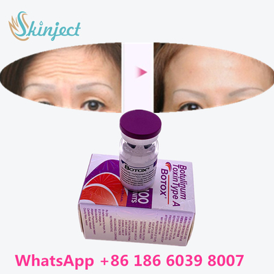 Botulinum Toxin  Wrinkle Removal 100u Allergan 100 Unit Untuk Injeksi Pengangkatan Wajah