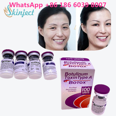 Botulinum Toxin  Wrinkle Removal 100u Allergan 100 Unit Untuk Injeksi Pengangkatan Wajah