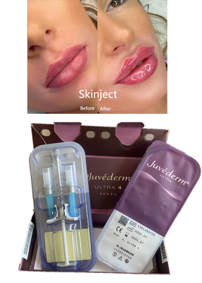 Injectable Deep Hyaluronic Acid Dermal 2ml Lip Filler Pipi Dagu Lipatan Nasolabial