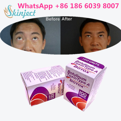 Botulinum Toxin Allergan s 1x100iu Untuk Keriput Wajah