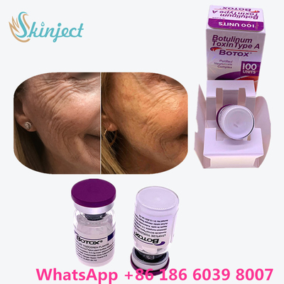 Botulinum Toxin Allergan  Type A 100unit 1 Vial / Kemasan Box