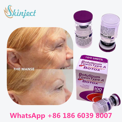 Botulinum Toxin Allergan  Type A 100unit 1 Vial / Kemasan Box
