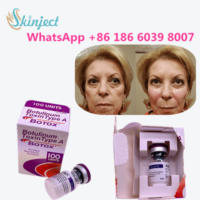 allergan botulinum toxin Produk Anti Penuaan Tipe A Toksin Anti Kerut