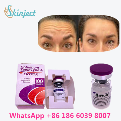 100% Original Botulinum Toxin  100u Untuk Menghilangkan Kerutan