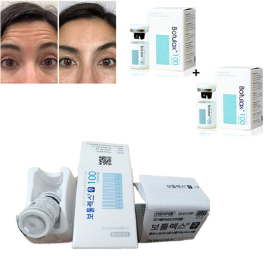 Korea Botulax 100 Unit Botulinum Toxin Type A Untuk Allergan Kerutan Dan Lipatan