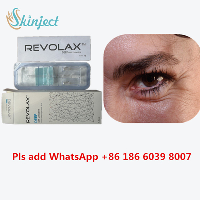 Suntikan Dermal Revolax Deep Filler Revolax Fine Sub-Q Untuk Hidung