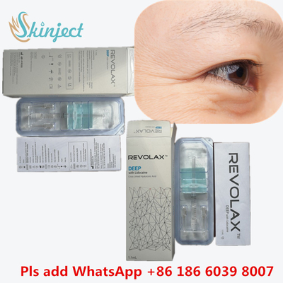 Suntikan Dermal Revolax Deep Filler Revolax Fine Sub-Q Untuk Hidung