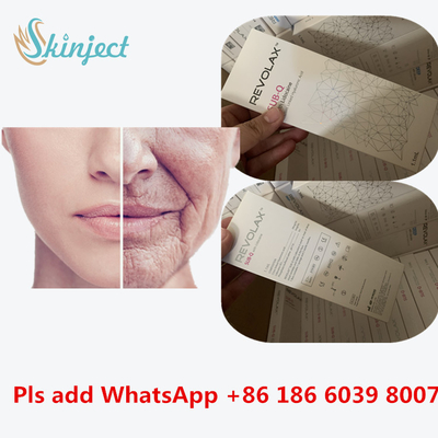 Suntikan Pengisi Dalam Revolax Tautan Silang Sub-Q Wajah Asam Hyaluronic