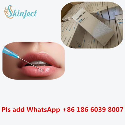 Suntikan Pengisi Dalam Revolax Tautan Silang Sub-Q Wajah Asam Hyaluronic