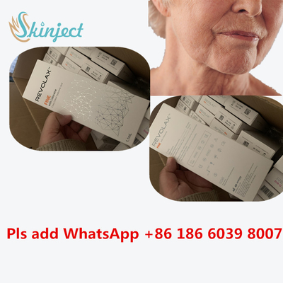 Suntikan Pengisi Dalam Revolax Tautan Silang Sub-Q Wajah Asam Hyaluronic