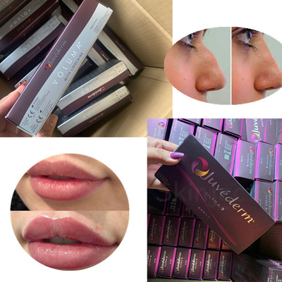 Ultra 3 Ultra 4 Juviderm Cross Linked Dermal Filler Steril Dengan Sertifikasi CE