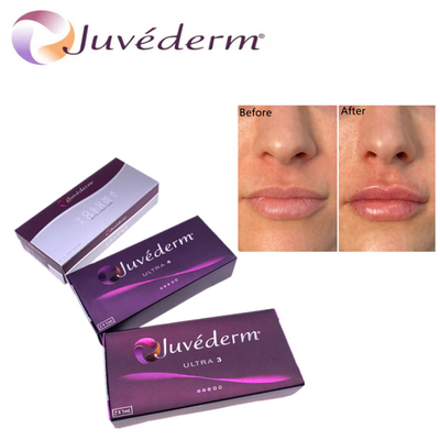 Hyluronic Acid Dermal Filler Premium Juvederm HA Facial Filler Ultra3 Ultra4 Volume Untuk Peremajaan Wajah