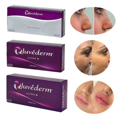 Juvederm 8-12 Bulan Pengisi Kulit Asam Hyaluronic Produk Injeksi Revolusioner