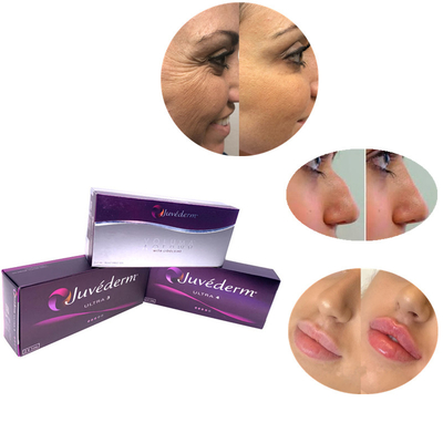 Pengisi Dermal Asam Hyaluronic Crosslinked Tanpa Rasa Sakit Untuk Perawatan Keriput