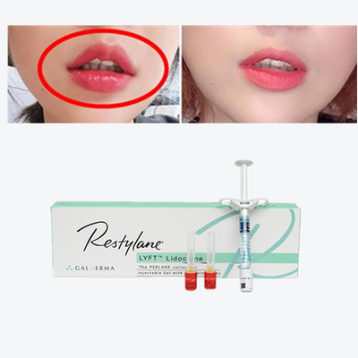 Vital  Perlane Cross Linked Dermal Filler Hyaluronic Acid Lyft Filler Kulit