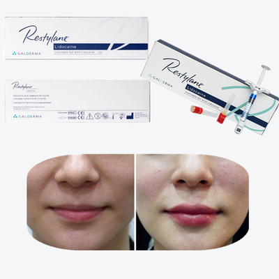 Juvederm Cross Linked Injectable Dermal Filler Untuk Bibir