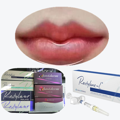 Juvederm Cross Linked Injectable Dermal Filler Untuk Bibir