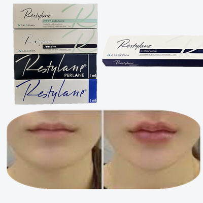 Cross Linked Hyaluronic Acid Dermal Filler Untuk Peningkatan Bibir Payudara