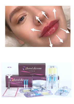 Juvederm' Hyaluronic Acid Dermal Filler Ultra3 Ultra4 Voluma Injeksi untuk Lip Filling