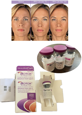 Anti keriput Botulinum Toxin Allergan 100IU 150iu ' Na