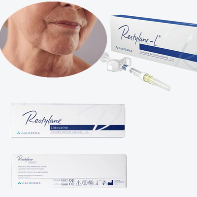 Cross Linked HA Hyaluronic Acid Facial Filler Untuk Garis hidung Kerutan hidung