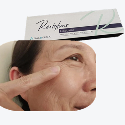 2*1ml/Kotak Hyaluronic Acid Breast Filler HA Dermal Fillers Untuk Garis Daun