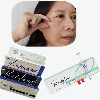 Kosmetik Cross Linked Dermal Filler HA Injeksi Untuk Sudut Mulut