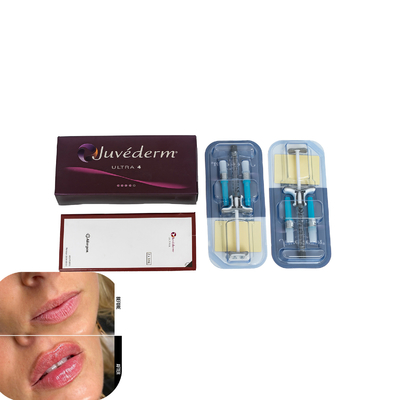 Juvederm Dermal Filler Untuk Bibir Injeksi Filler Asam Hyaluronic