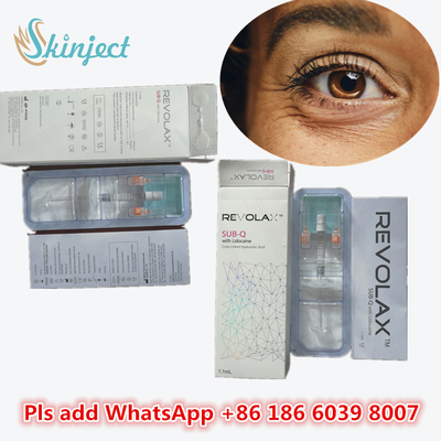 2ml Filler Injeksi Dermal Hyaluronic Acid Filler Wajah Untuk Bibir