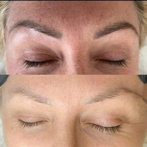 Penghapusan alis Penghapusan rambut Mesin kecantikan laser 810nm Mesin Laser Penghapusan Tato