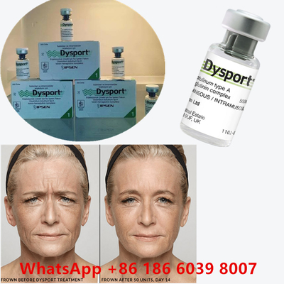 Botulinum Toxin 100 Unit BTX Injeksi Tipe A Penggunaan kosmetik