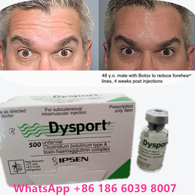 Botulinum Toxin 100 Unit BTX Injeksi Tipe A Penggunaan kosmetik