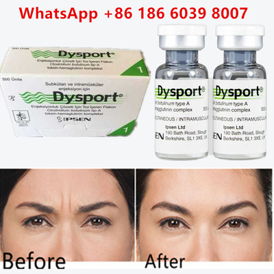 Botulinum Toxin Dysport 100u Clostridium Botulinum Tipe A Untuk Kerutan Dahi