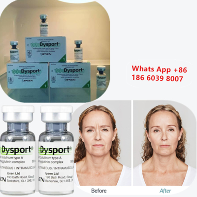 Botulinum Toxin Tipe A Disport Injeksi untuk Pengurangan Kerutan