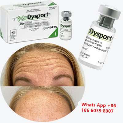 Botulinum Toxin Tipe A Disport Injeksi untuk Pengurangan Kerutan