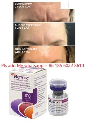 Allergan Botox 100IU Suntikan Dysport Botulax Toksin Botulinum Hilangkan Kerutan