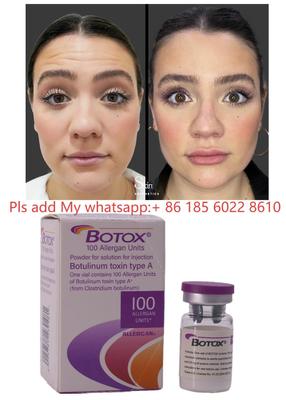 Toksin Botulinum Botulax Dysport Allergan Botox untuk Pengurangan Kerutan dan Kosmetik