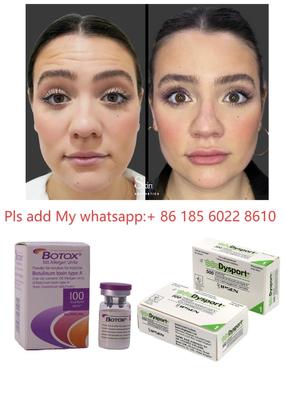 Toksin Botulinum Allergan Botox 100IU untuk Pengurangan Kerutan dan Kosmetik